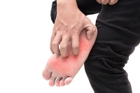What Children Need to Know About Athlete’s Foot